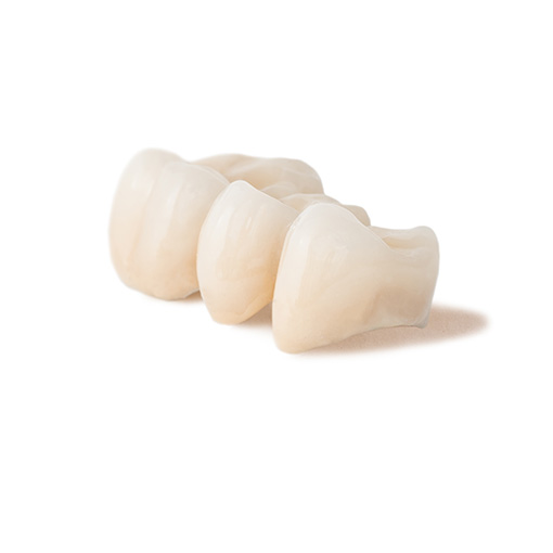 Temple City dental crowns