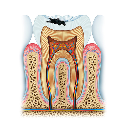 dental fillings and treatment